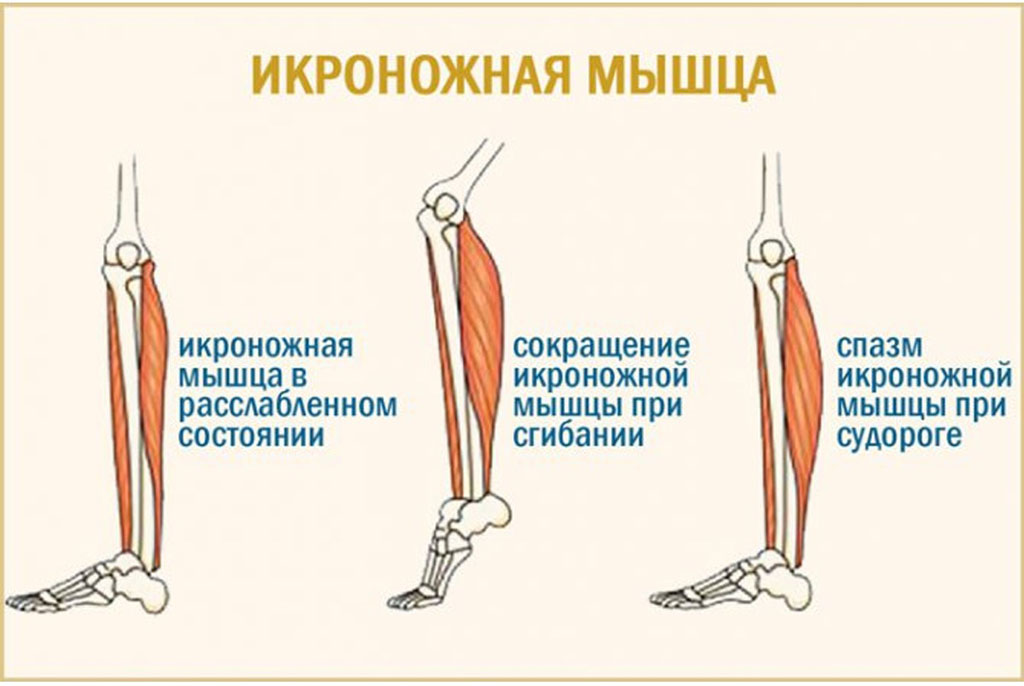 свести